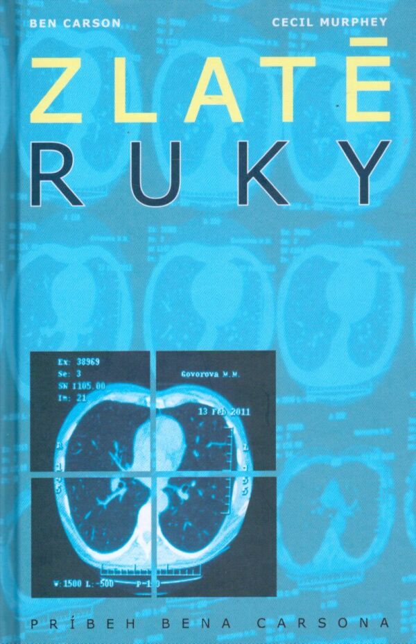 Ben Carson, Cecil Murphy: ZLATÉ RUKY