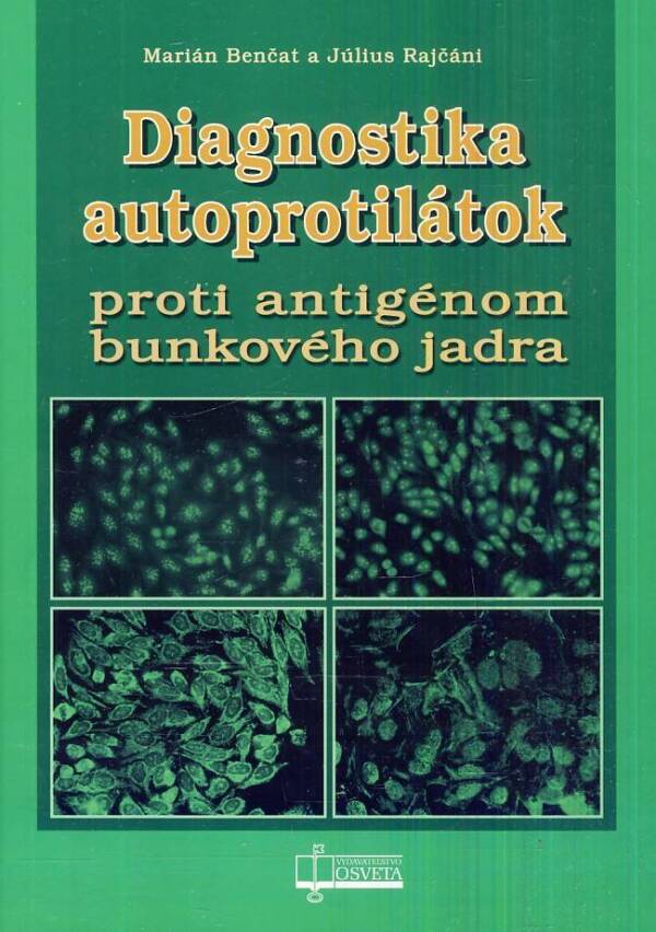 Marián Benčat, Július Rajčáni: DIAGNOSTIKA AUTOPROTILÁTOK PROTI ANTIGÉNOM BUNKOVÉHO JADRA