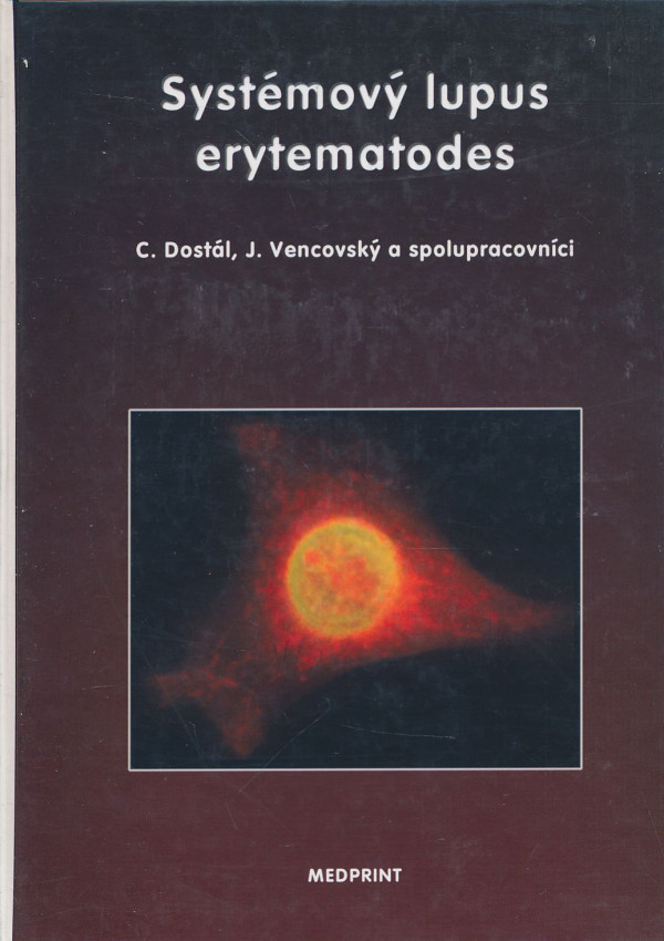 C. Dostál, J. Vencovský: Systémový lupus erytematodes