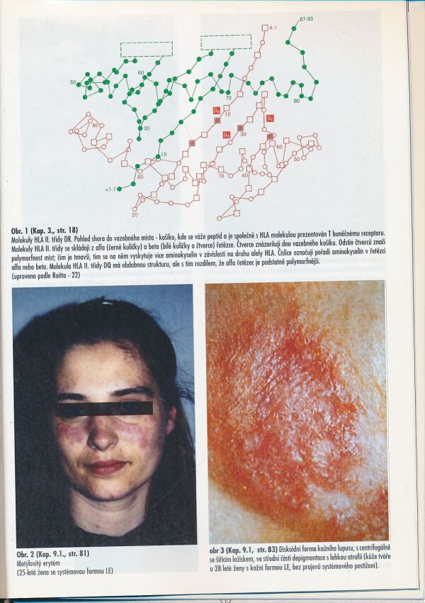 C. Dostál, J. Vencovský: Systémový lupus erytematodes