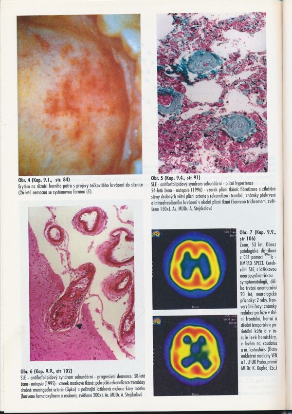 C. Dostál, J. Vencovský: Systémový lupus erytematodes