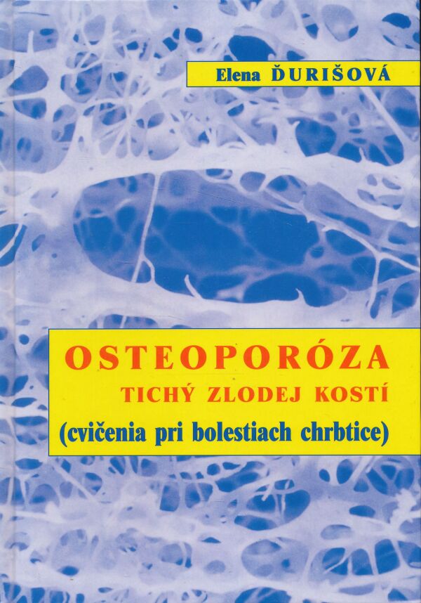 Elena Ďurišová: Osteoporóza tichý zlodej kostí