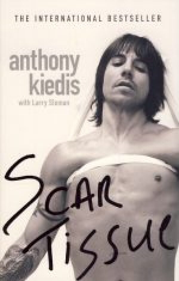 Anthony Kiedis: